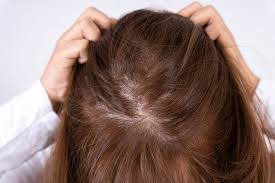 haarverzorging tips vrouwen