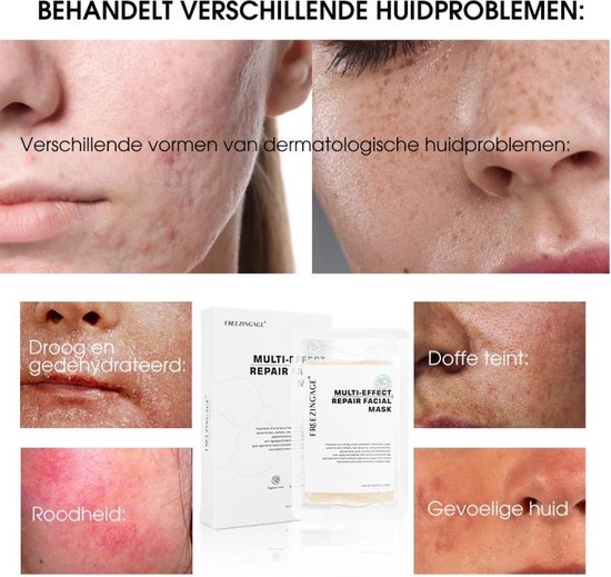 gezichtsmasker voor gevoelige huid